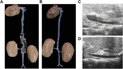 Single-Cell RNA Sequencing Reveals Smooth Muscle Cells Heterogeneity in Experimental Aortic Dissection